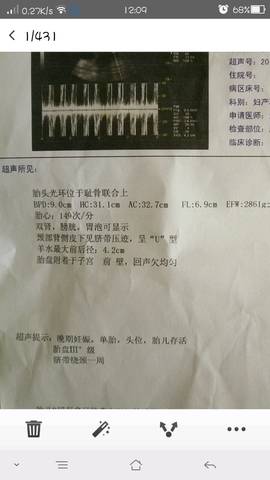 journal_insert_pic_850025753
