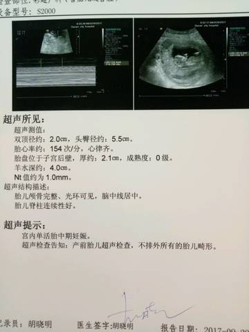 journal_insert_pic_849601488