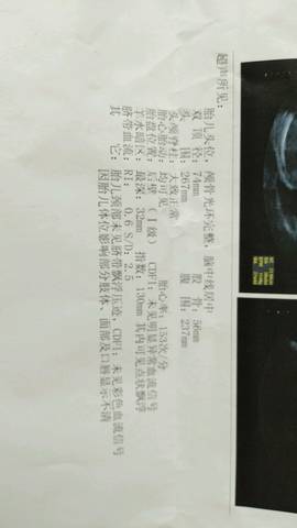 journal_insert_pic_849781679