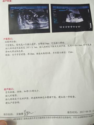 journal_insert_pic_850998552