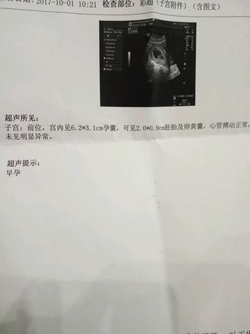 journal_insert_pic_852418289