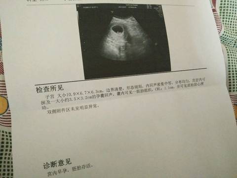 journal_insert_pic_855730762