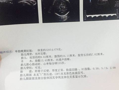 journal_insert_pic_857241048