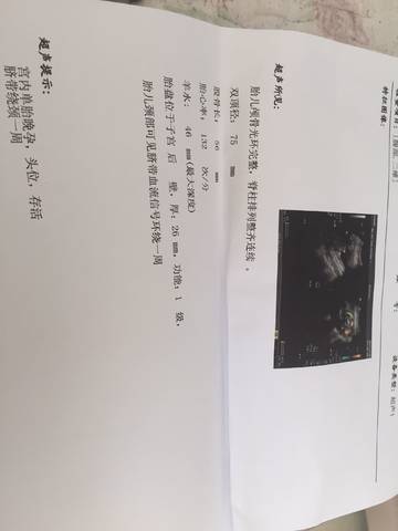 journal_insert_pic_857579301