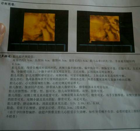 journal_insert_pic_861047194