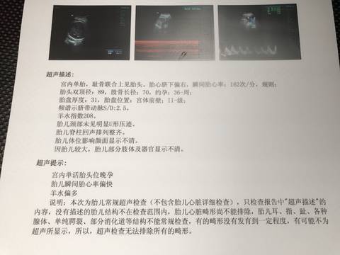 journal_insert_pic_863325650