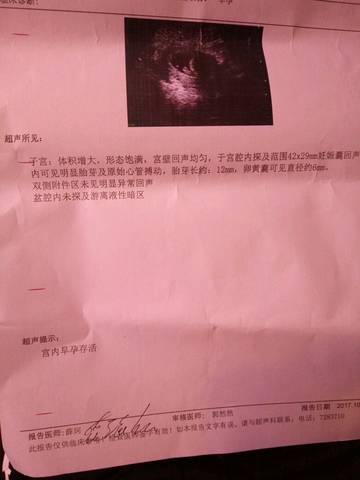 journal_insert_pic_863311135