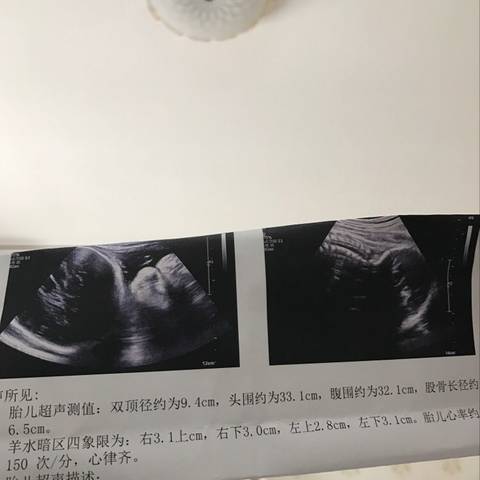 journal_insert_pic_863103913