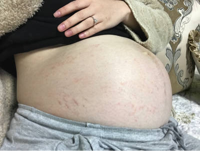 journal_insert_pic_864792602