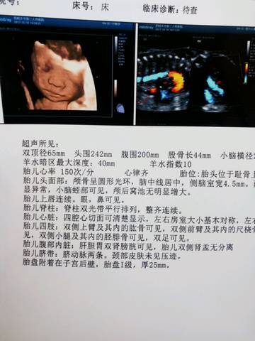 journal_insert_pic_865427200