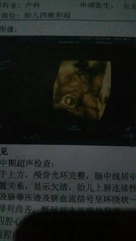 journal_insert_pic_867740543