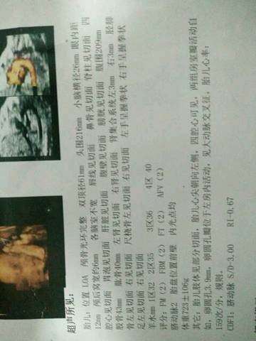 journal_insert_pic_871933358