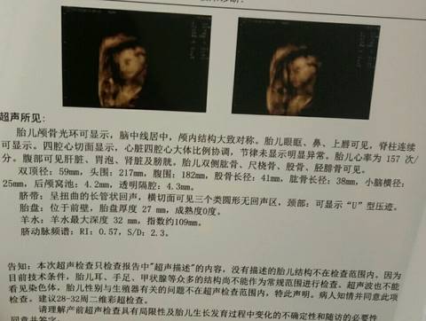 journal_insert_pic_873388343