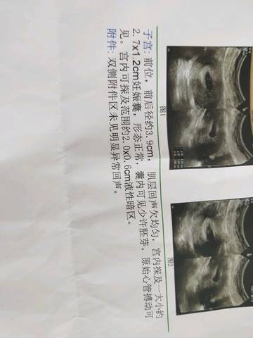 journal_insert_pic_875482359