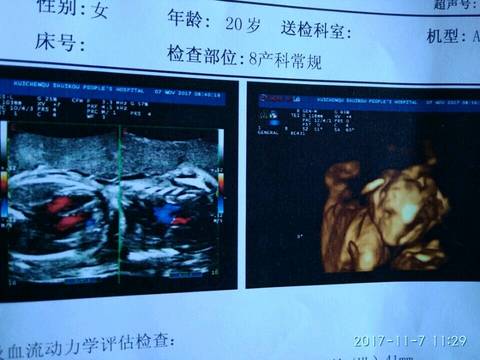 journal_insert_pic_879061658