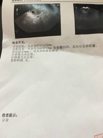 journal_insert_pic_879908598