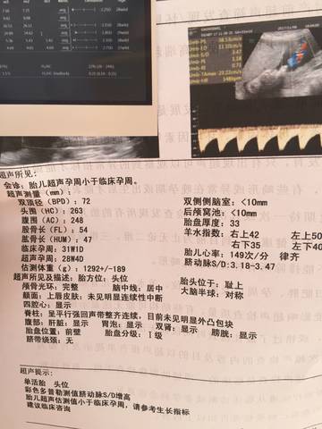 journal_insert_pic_879716782