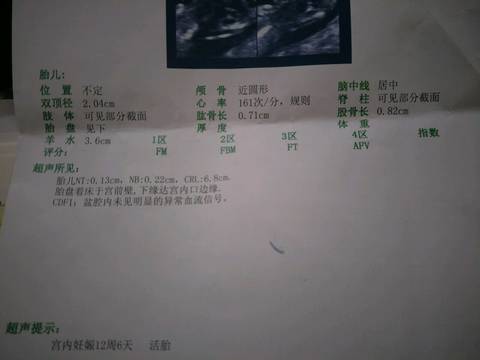 journal_insert_pic_880725046