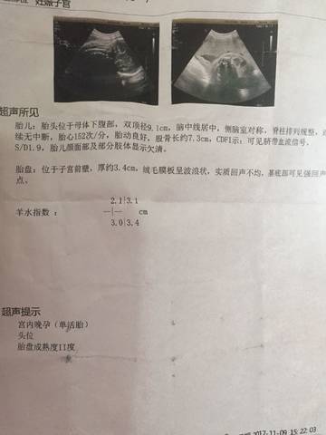 journal_insert_pic_881102613