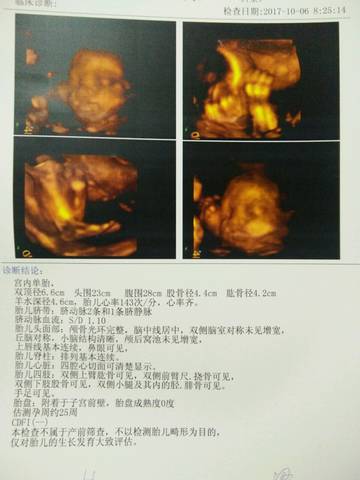 journal_insert_pic_881372258