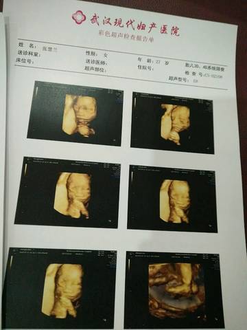 journal_insert_pic_882205169