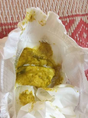 宝宝拉粑粑这样正常吗