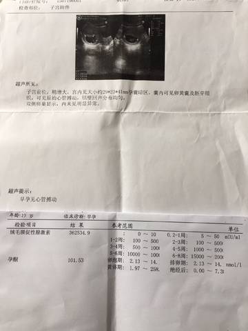journal_insert_pic_883230708