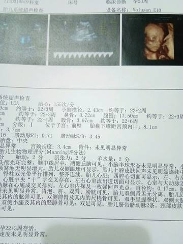 journal_insert_pic_884831179