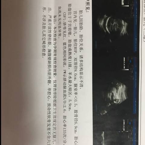 journal_insert_pic_885624120