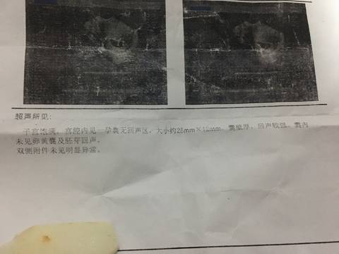 journal_insert_pic_886900076