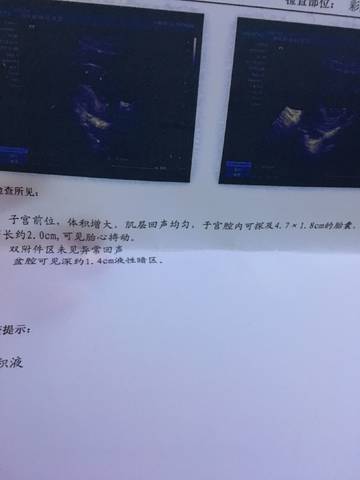 journal_insert_pic_889264067