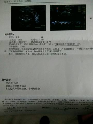 journal_insert_pic_889831837