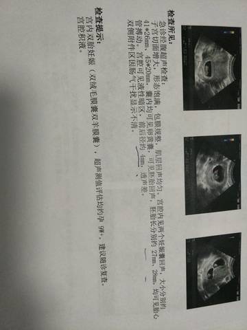 journal_insert_pic_891759913