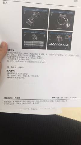 journal_insert_pic_892957360