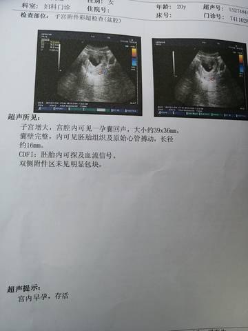 journal_insert_pic_892972083