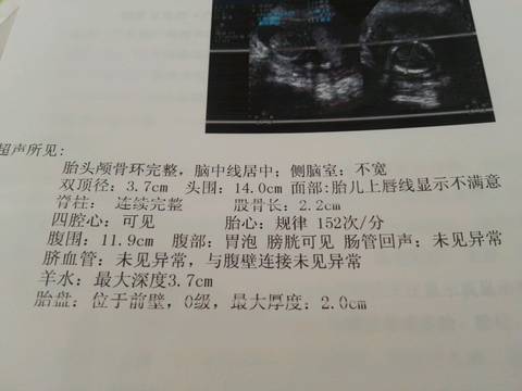 journal_insert_pic_893414133