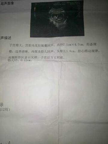 journal_insert_pic_898433215