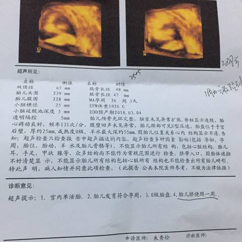 journal_insert_pic_901324654