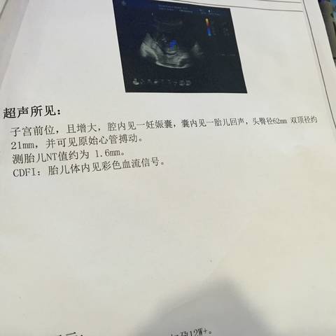 journal_insert_pic_904355943