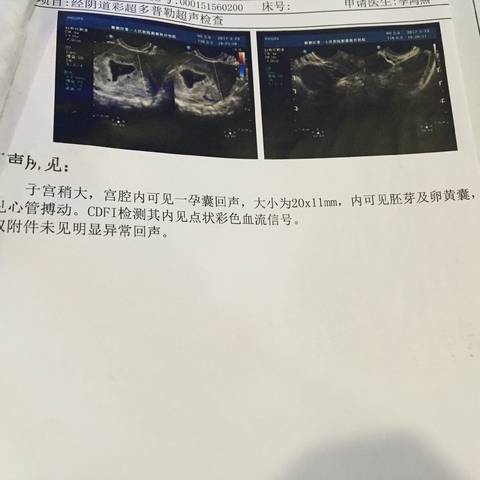 journal_insert_pic_904355515