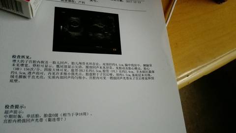 journal_insert_pic_904342913