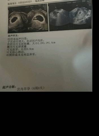 journal_insert_pic_909559315