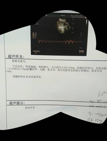 journal_insert_pic_909553420