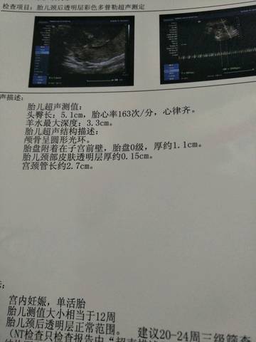 journal_insert_pic_909577852