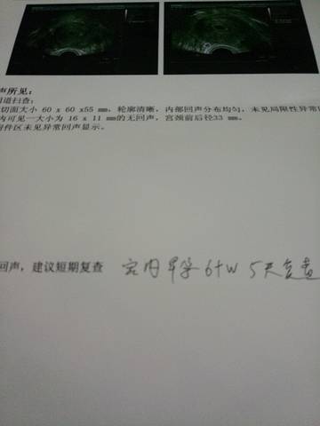 journal_insert_pic_910340326