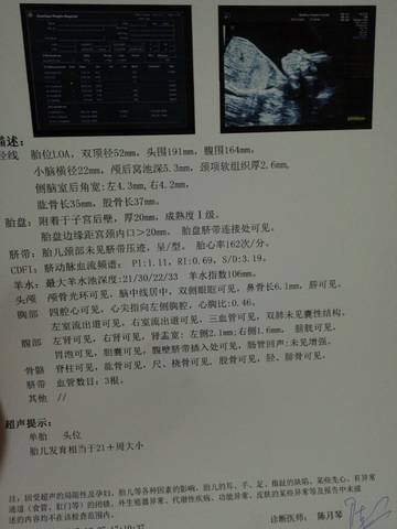 journal_insert_pic_913356071