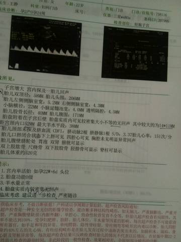 journal_insert_pic_913890262