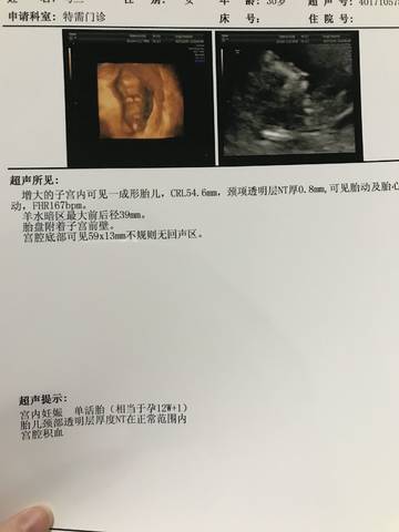 journal_insert_pic_914538142