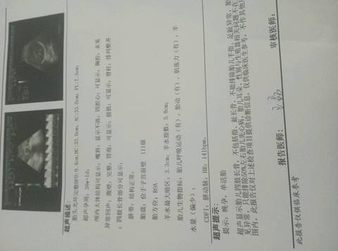 journal_insert_pic_915705139