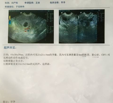 journal_insert_pic_915914653